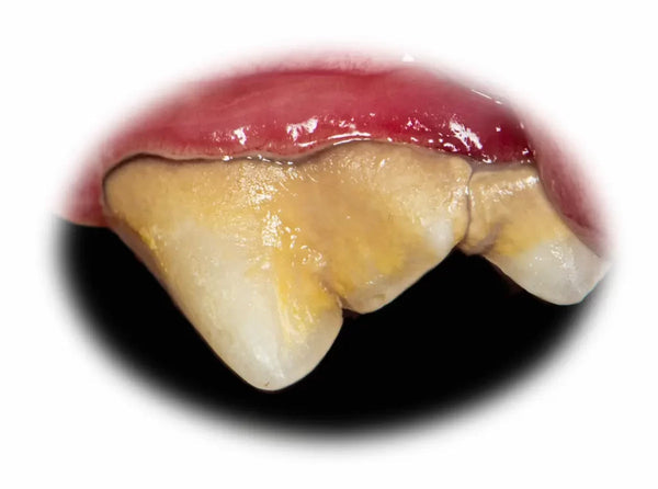 Hardened tartar on a dog's tooth