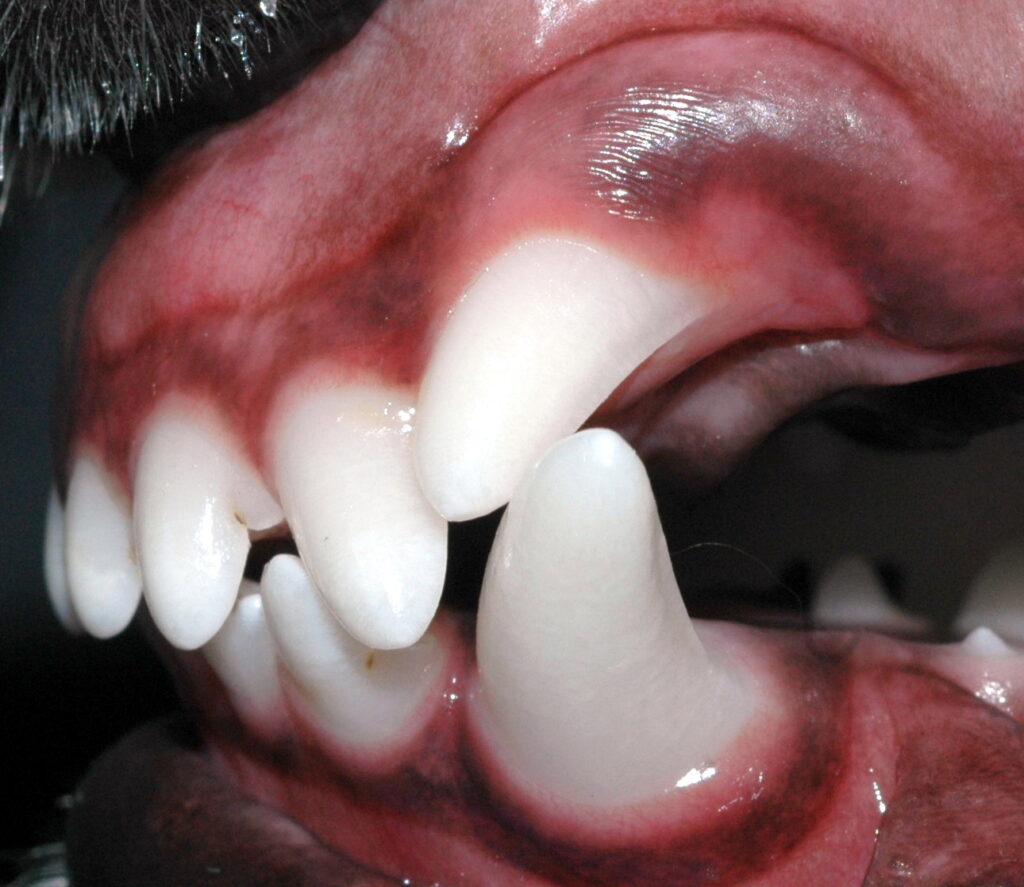 Malpositioned upper canine tooth