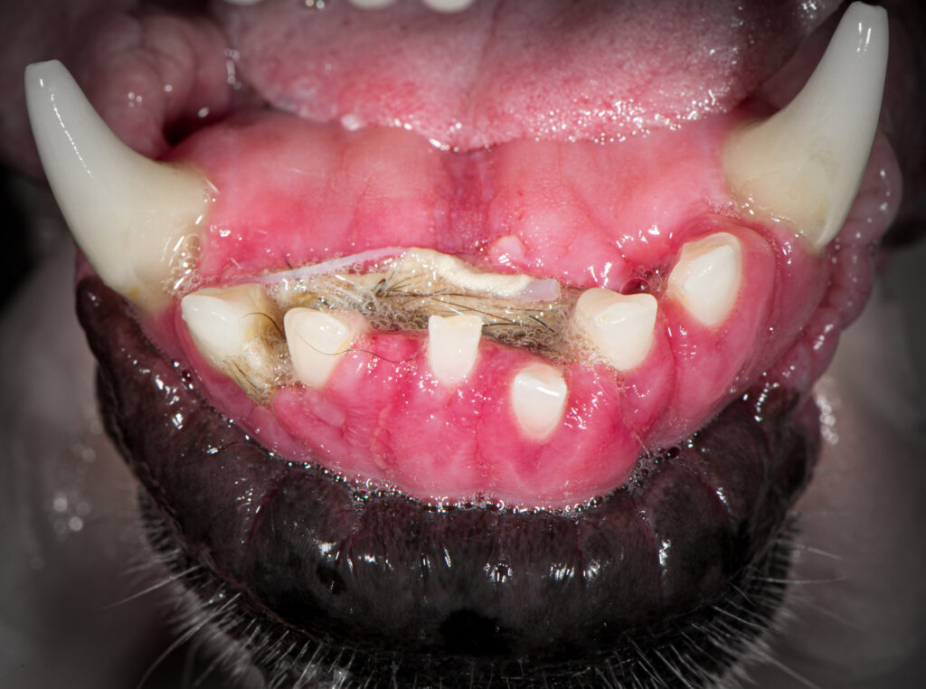 damage to lower jaw caused by underbite